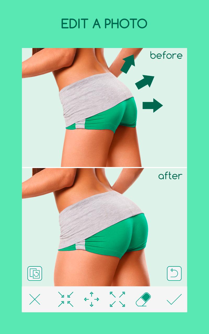 Liposuction